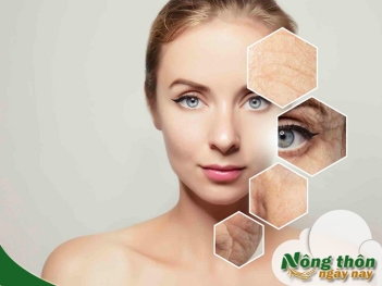Công dụng của trà xanh trong làm đẹp da mới phát hiện - Nông Thôn ngày nay