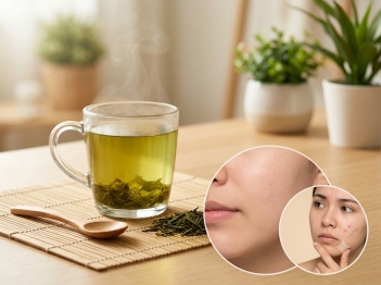 Uống trà xanh có nổi mụn không